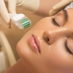 mesotherapy
