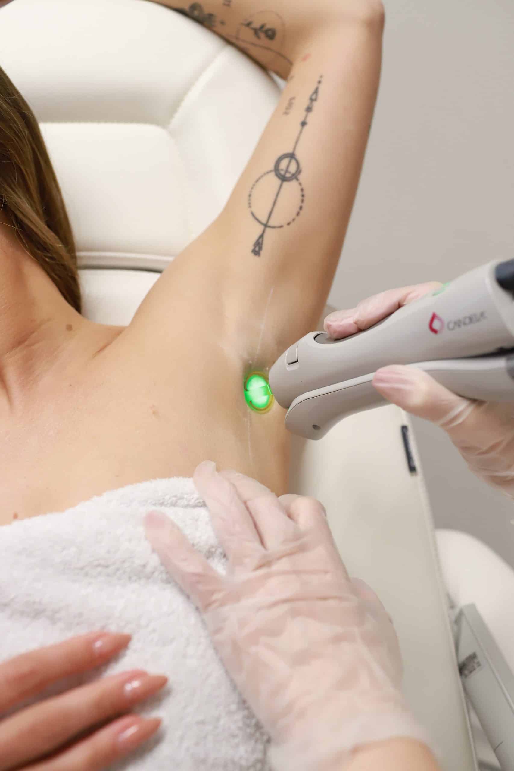 GentleMax Pro laser
